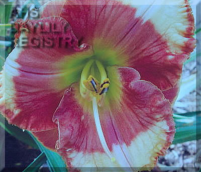 Forsyth Transfusion AHS image