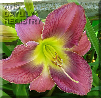 Fordon AHS image
