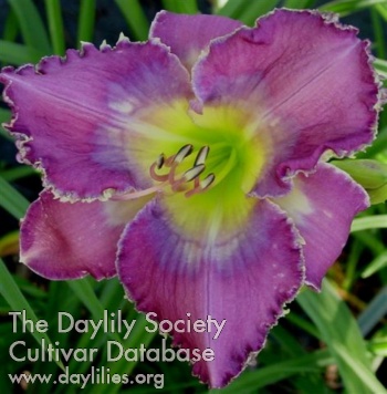 See the Symphony AHS image